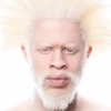 ALBINO-NEGERs avatar